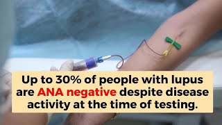 Time to rethink ANA as a lupus biomarker