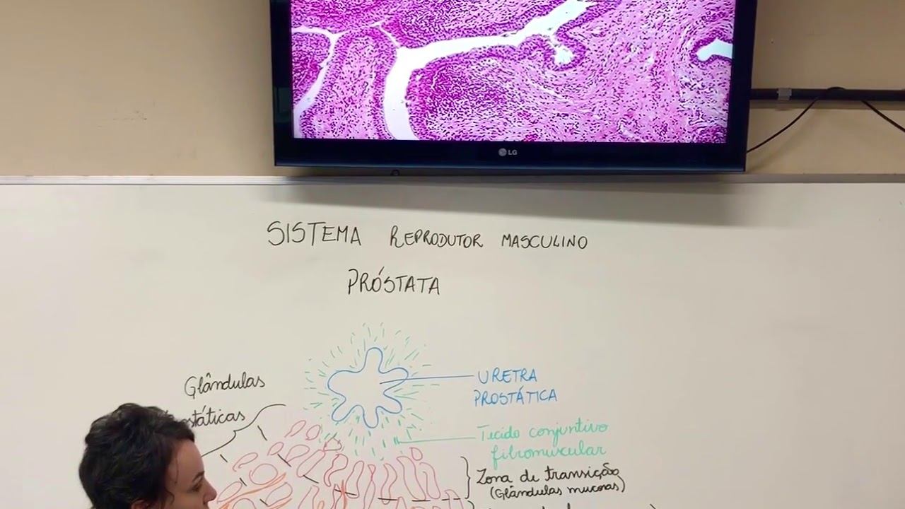Sistema Reprodutor Masculino - Próstata