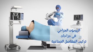 الروبوت الجراحي: تقنية الروبوت في عمليات تركيب المفاصل الصناعية