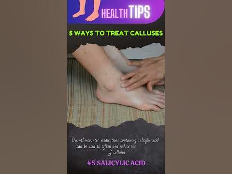 6 Ways to Treat Calluses #shorts #tips #calluses #footcare #