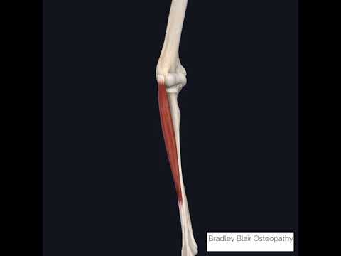 Dry needling for