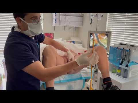 Catheter Insertion At Z Urology