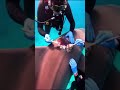 Divers Save Injured Shark by Removing Barnacles & Healing Its Wounds#rescueanimals #oceanhealing