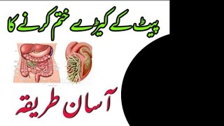 An easy way to get rid of stomach worms | #sohailsodozahitube | #worms | #paitkekeronkeilaj