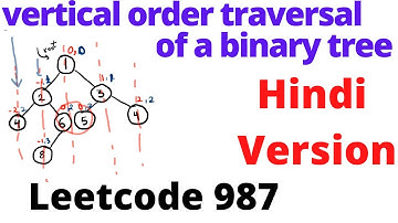 Vertical Order Traversal of a Binary Tree | leetcode 987 | Hindi