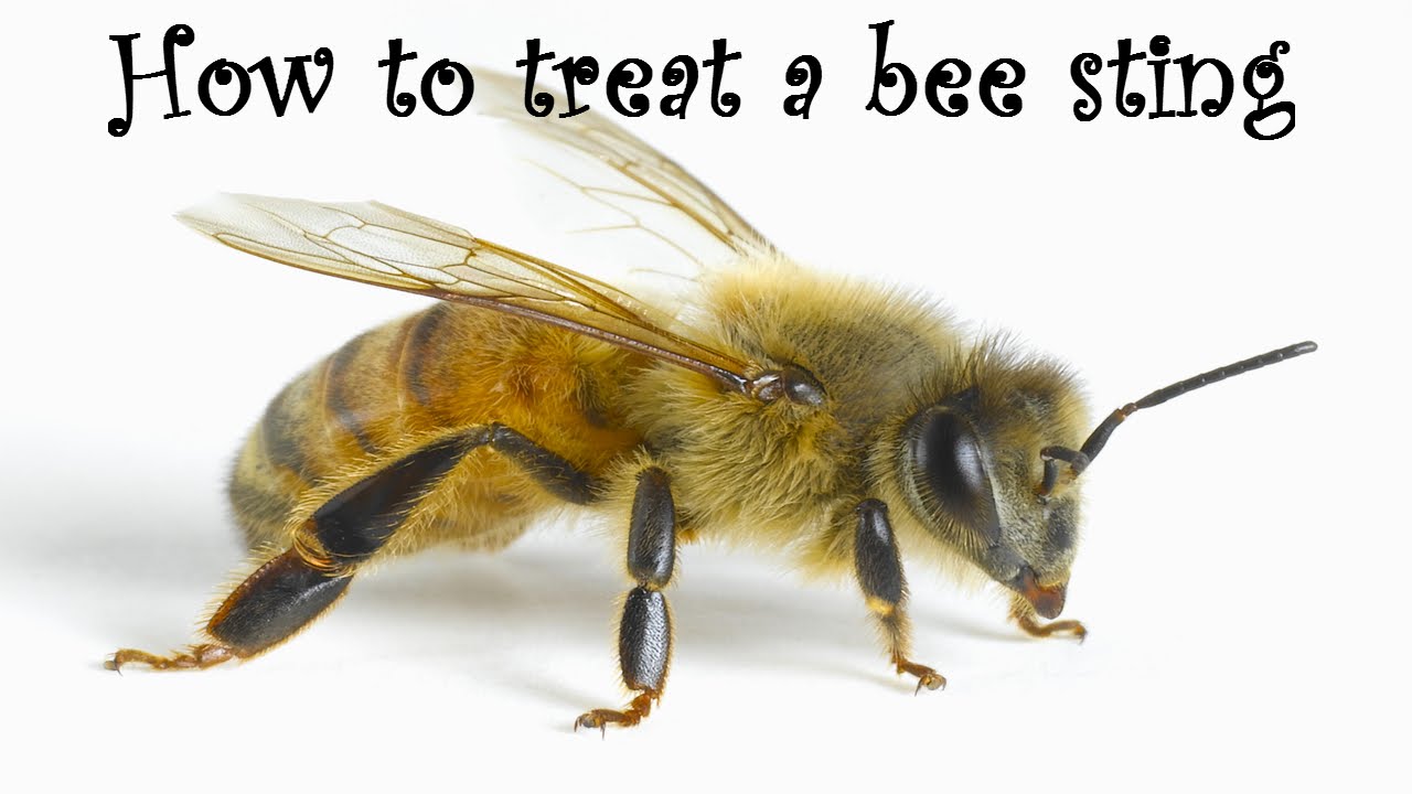 How do you treat bee stings at home?