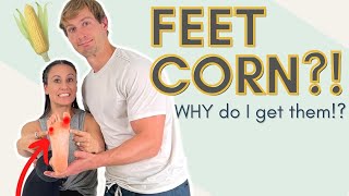 Why do I have corns at the bottom of my feet