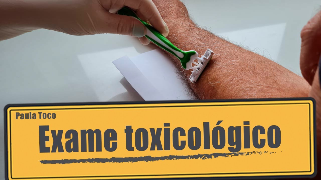 Tirando dúvidas sobre o exame toxicológico