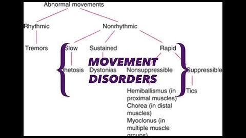 MOVEMENT DISORDERS WITH VIDEO EXAMPLES