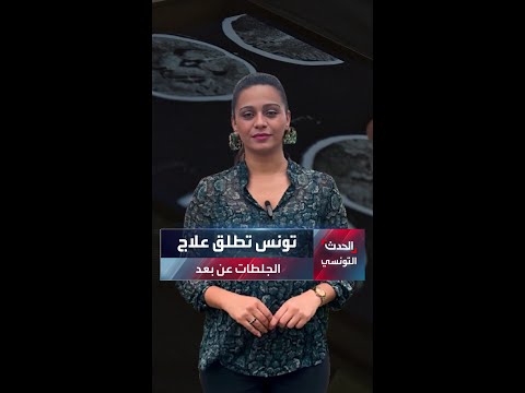 تونس تطلق تقنية جديدة لعلاج الجلطات الدماغية عن بعد