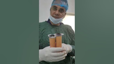 fat grafting for girth increase. 8882126505 / 9818565166