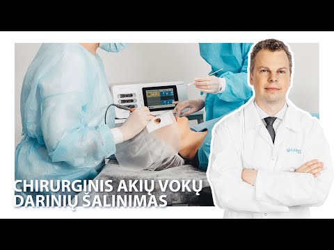 Video: Nenormalus Akių Vokas Katėms