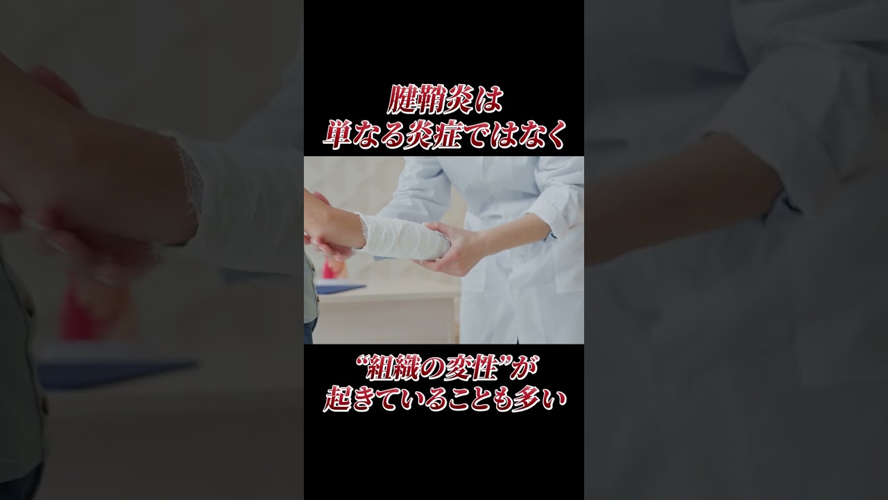 【たった1分】腱鞘炎は簡単に治ります!