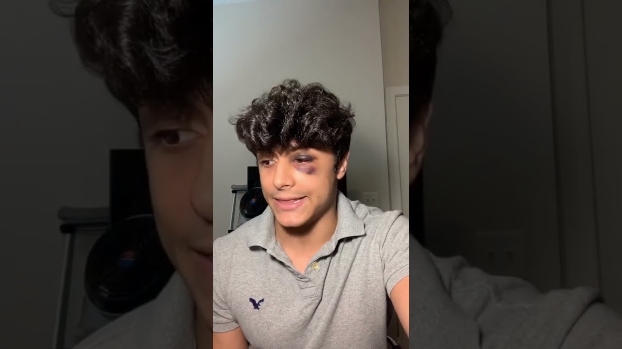 How I Got Robbed Pt. 3