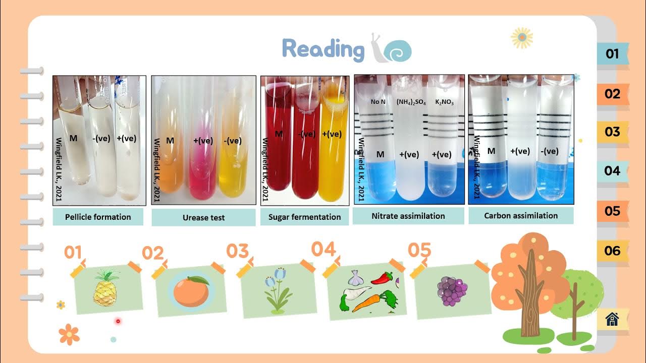 Exercise Yeast Identification (biochemical test) YouTube