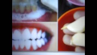 Celebrity KORA IBI MU MINOTA 2 GUSA, UGIRE AMENYO Y'UMWERU/ Amenyo y'umweru dede!!! Net Worth