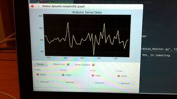 Frustrations with the elecret mic