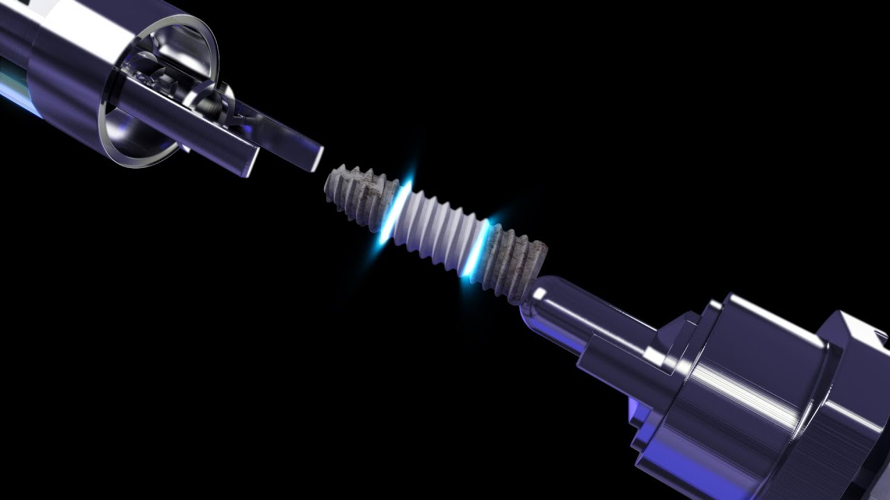 [Point Implant] Point UV Implant