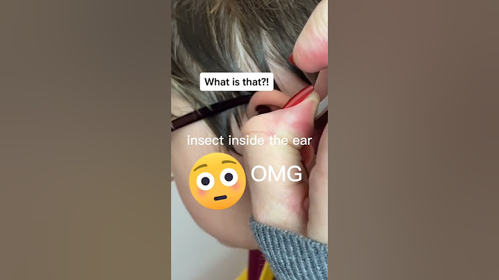 OMG,😲INSECT INSIDE THE EAR ||elinor dacquel