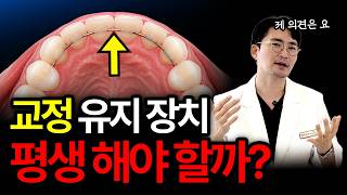 치아 교정 유지 장치 평생 하는 이유 ㅣ교정 유지 장치 기간 딱! 알려 드립니다.