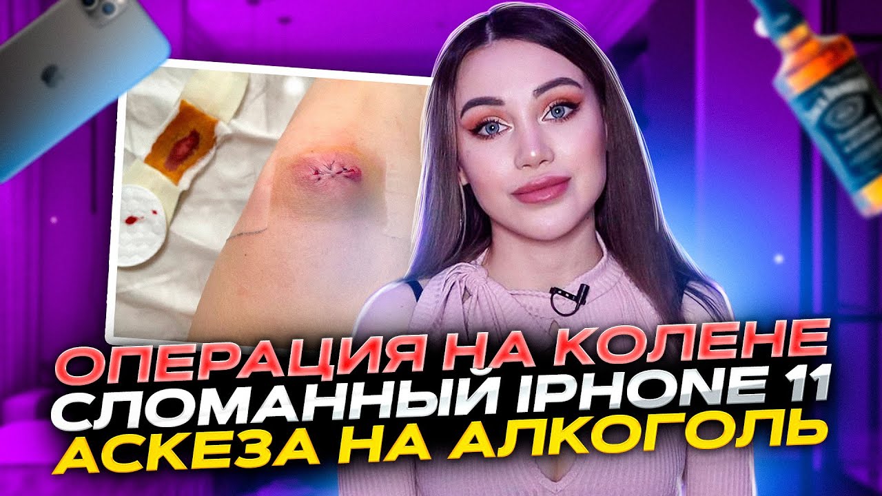 Операция на колене, сломанный IPhone 11, аскеза на алкоголь ...
