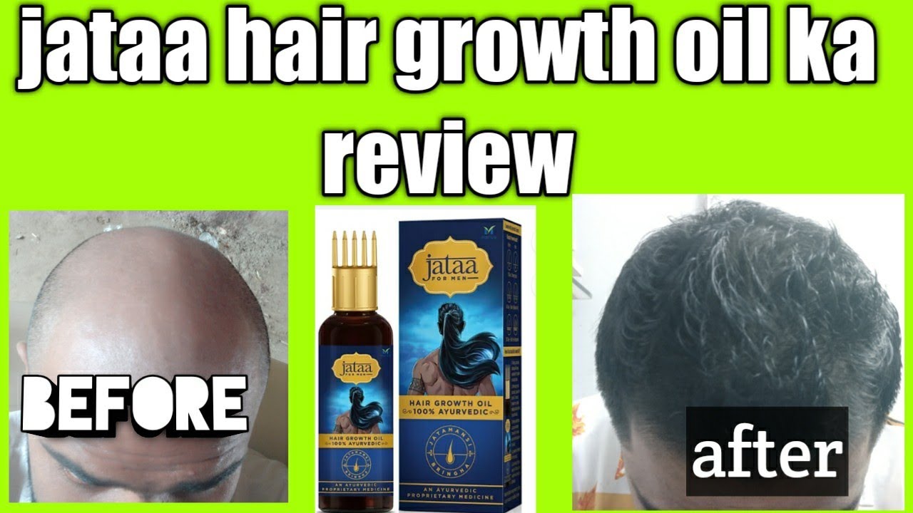 Jataa hair growth oil review for men jataa हेयर ग्रोथ ऑयल रिव्यू फॉर