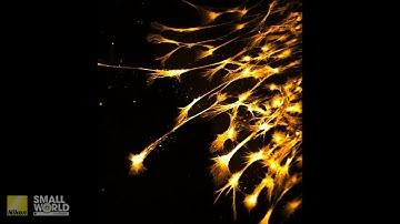 In vitro growth of chick sensory neurons | 2025 Nikon Small World