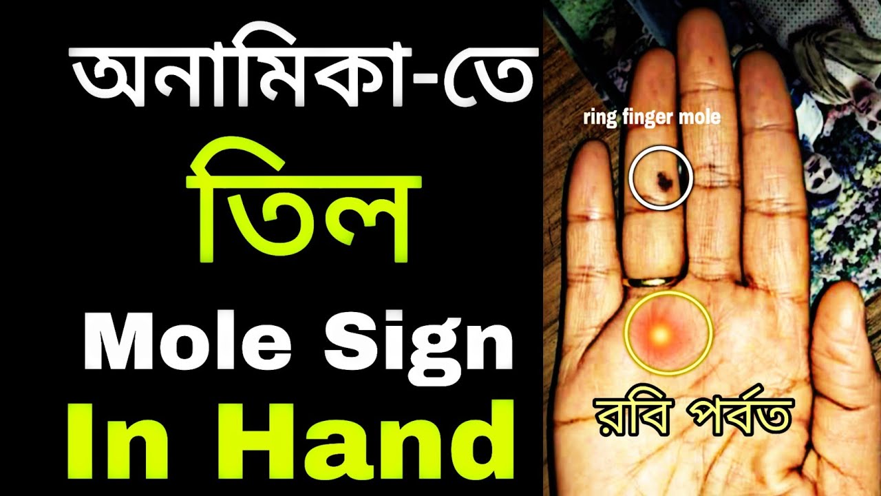 Moles and Palmistry To understand the... - Palmistry BY ALOK | Facebook