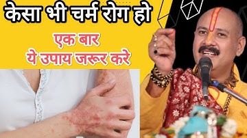 केसा भी चर्म रोग हो एक बार ये उपाय जरूर करें Pradeep Mishra Ji Ke Upaay
