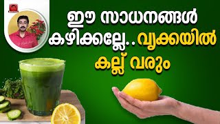 ഈ സാധനങ്ങൾ കഴിക്കല്ലേ.. വൃക്കയിൽ കല്ല് വരും Kidney Stone Diet.