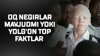 OQ NEGIRLAR MAVJUDMI YOKI YOLG'ON TOP FAKTLAR  (OQ TANLI ODAMLAR)