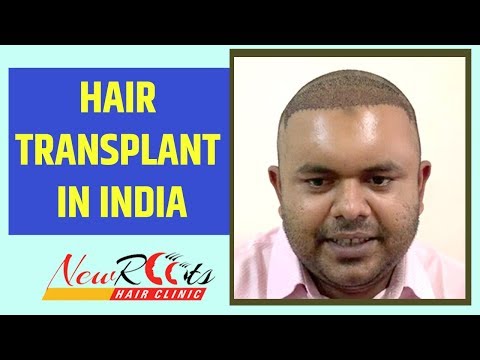 hair-transplant-in-india-|-new-roots-hair-clinic-|-hair-transplant-tourism