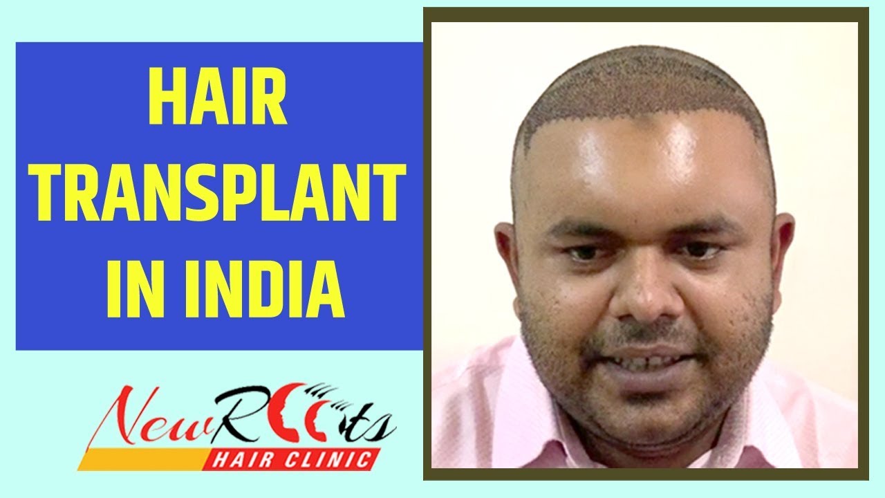 Hair Transplant In Dhaka New Roots Hair Clinic NEWROOTS YouTube Hair Transplant In Dhaka New Roots Hair Clinic NEWROOTS YouTube