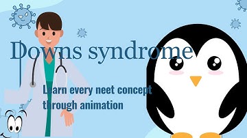 downs syndrome