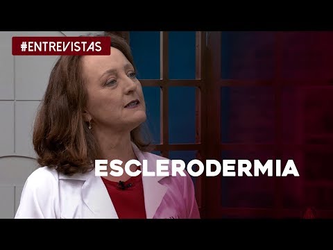 Vídeo: Esclerodermia Linear “em Golpe De Sabre” Com Extenso Envolvimento Cerebral - Correlações Clínico-patológicas E Resposta à Terapia Anti-interleucina-6