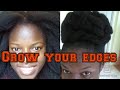 How to regrow your Edges fast/ 4c natural hair growth challenge series. Traction alopecia treatment