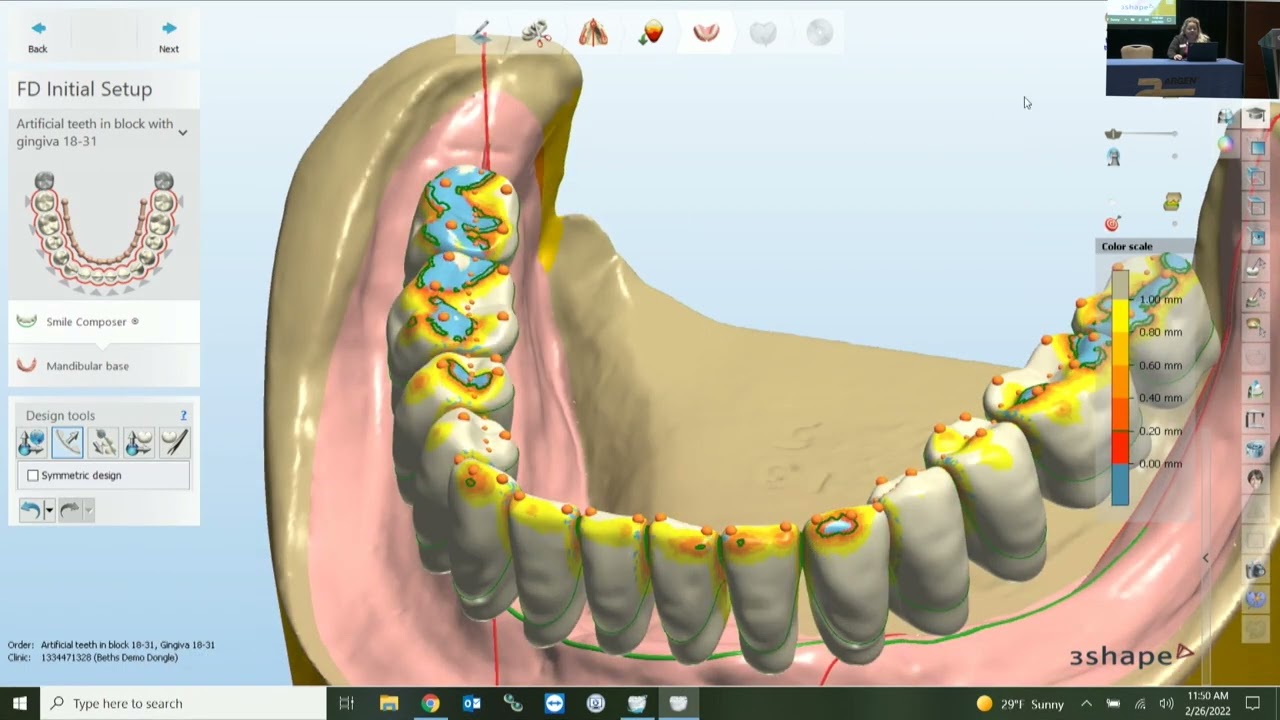 健康・医学 Best Denture Design design-high-quality-dentures-