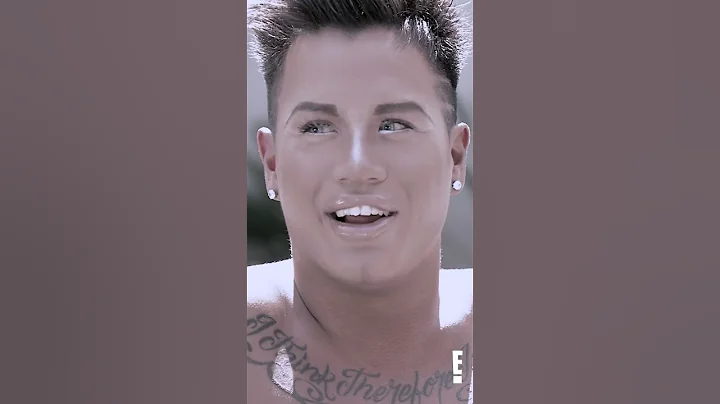 Jonathan didn't listen to the #botched drs when it came to his lip #filler & now he's back! #shorts