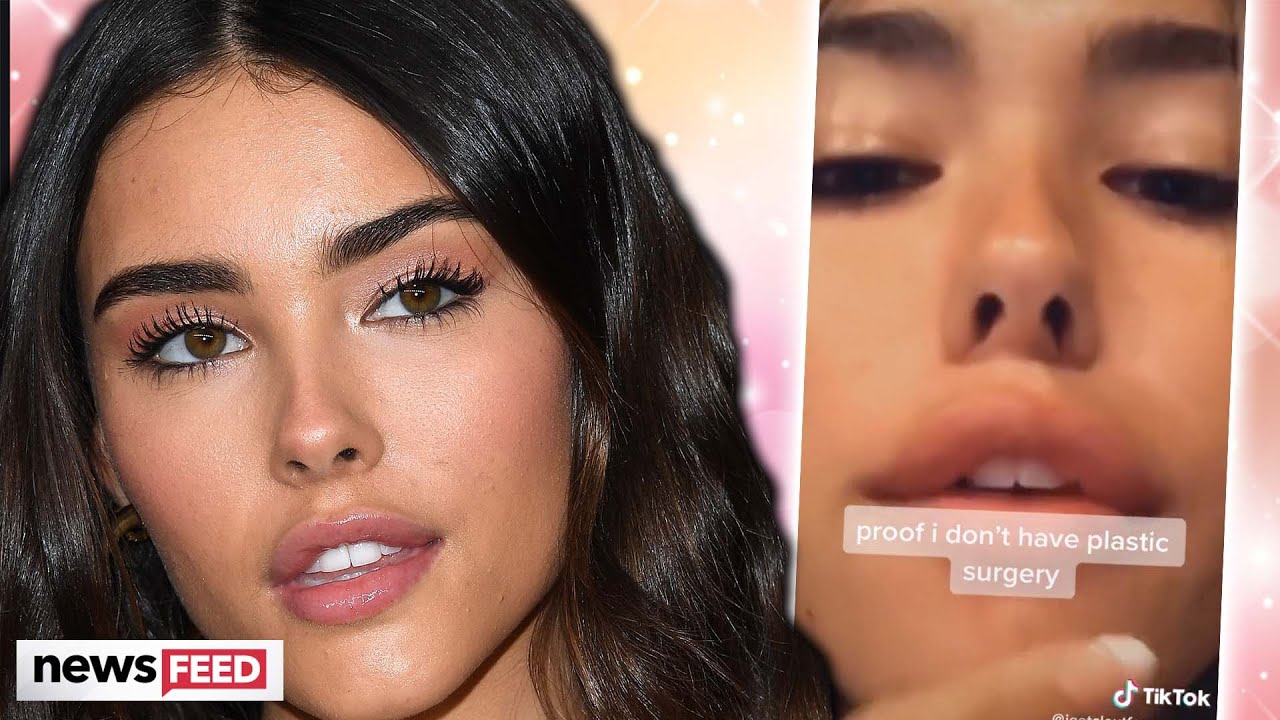 Madison Beer's Plastic Surgery Procedures DEBUNKED! - YouTube