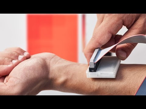 Video: Hadiah Dyson Diberikan Kepada Penemu Skin Cancer Scanner