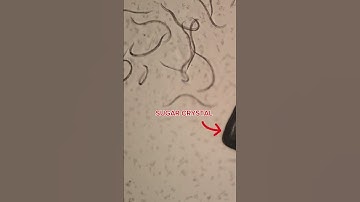 Sugar vs Parasites under the Microscope #health #guthealth #naturalremedies #viralshort