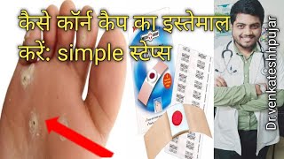 What Is Corn Caphow To Apply Corn Capcorn Capsapply Corn Caphindi Explanation
