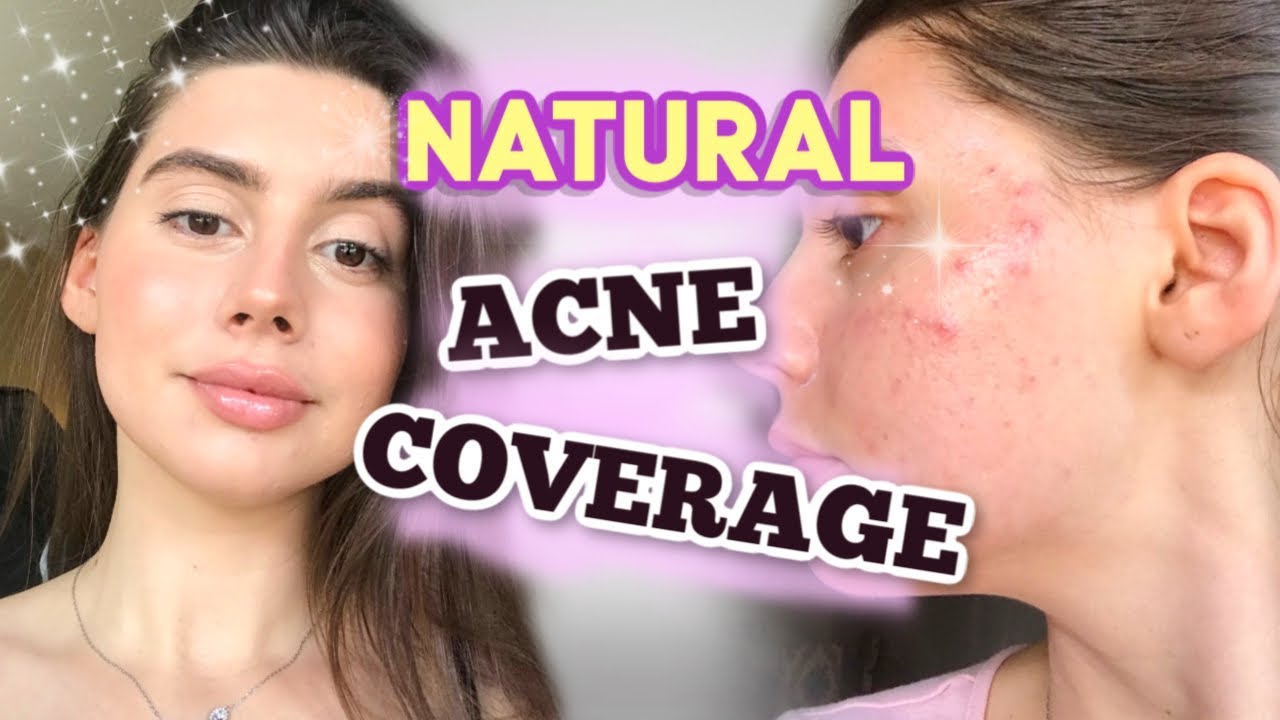 HOW TO COVER UP ACNE NATURALLY W/ MAKEUP 2021 GOLDEN HOUR acne