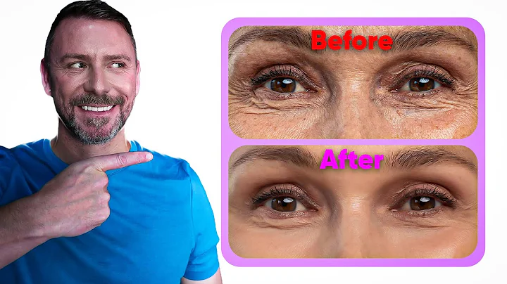 THIS EYE CREAM HACK WILL BLOW YOUR MIND! (LINES BE GONE!) - DayDayNews