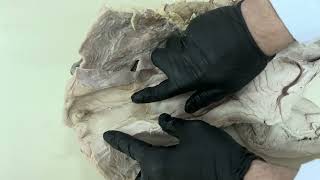 Organa Geni̇tali̇a Femi̇ni̇na , Ovari̇um , Tuba Uteri̇na , Uterus , Vagi̇na