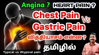 Heart Attack Pain in tamil | cardiac pain|symptoms|Angina in tamil Chest pain in tamil | Ps tamil