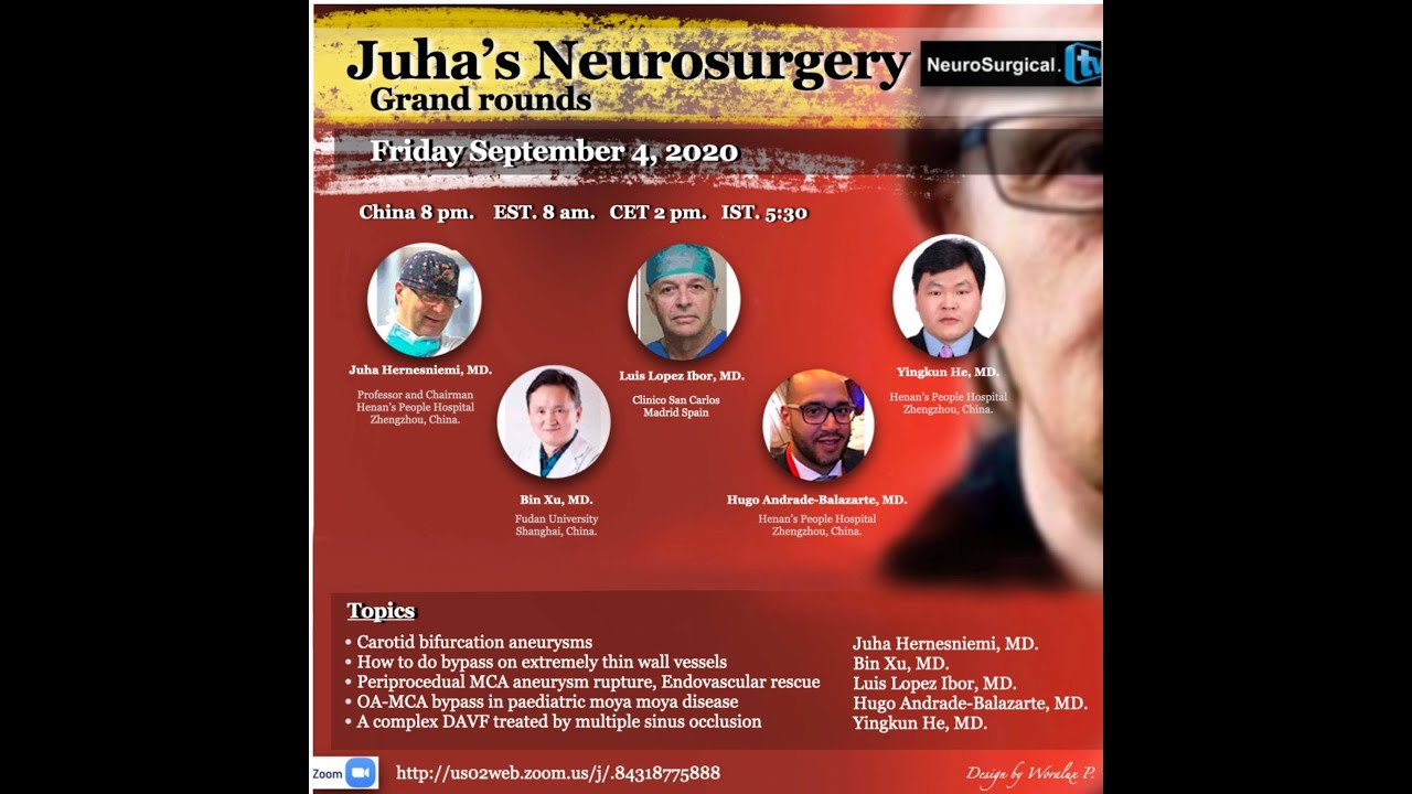 Dural Ateriovenous Fistula