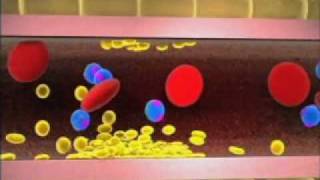 Diabetes Basics: Fat & Diabetes