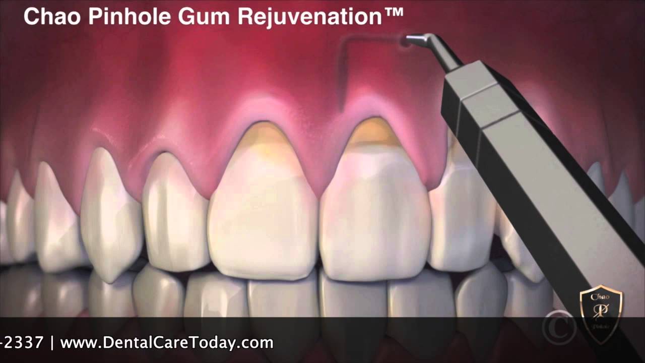 Dr  Dale Behner DDS PST July 22