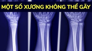 12 đặc điểm cực kì hiếm gặp trên cơ thể người